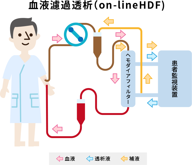 科學家改變沸石的特性以改善血液透析